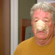 Image for article titled Dr. Pimple Popper Knows Nose (Particularly, Nose Caked in Pus and Sebum)